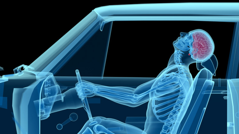Human anatomy in a car crash, bones and brain